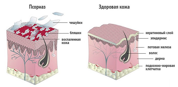 Шелушение и сухость кожи на шее, сзади, за ушами, под волосами. Причины