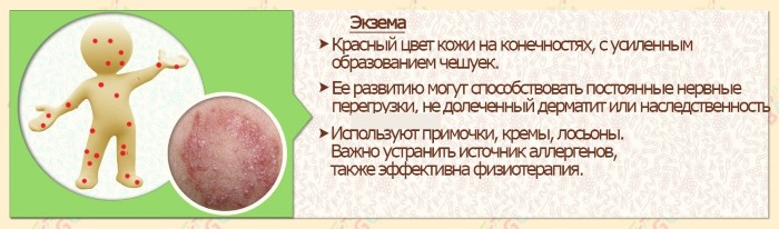 Шелушится и чешется кожа тела, головы, на лице появляются сухие красные пятна. Что это и как лечить