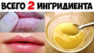 Очень ПИТАТЕЛЬНАЯ Маска для 💋ГУБ от ШЕЛУШЕНИЯ ✅Получите НАТУРАЛЬНЫЕ Мягкие Розовые Губы МГНОВЕННО