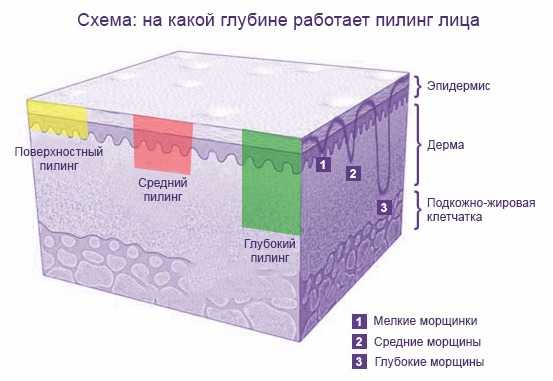 Пилинг какой лучше