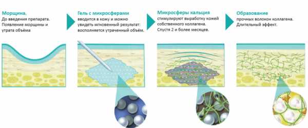 Радиесс препарат